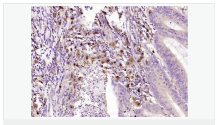 6052bbcee324c.png image.png