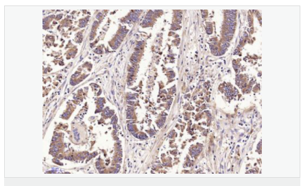 6052bc877ac01.png image.png