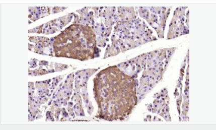 60543c6c22cfd.png image.png