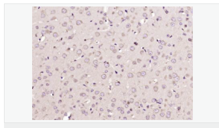 6054462bdd8ab.png image.png