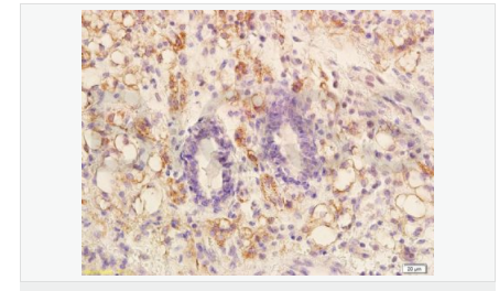 60595e72bf841.png image.png