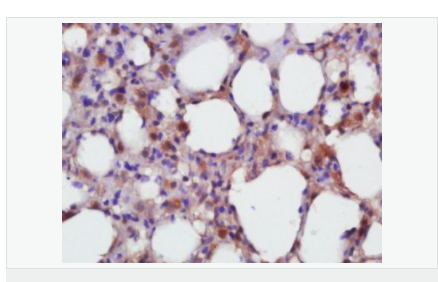 605d84395a4bf.png image.png