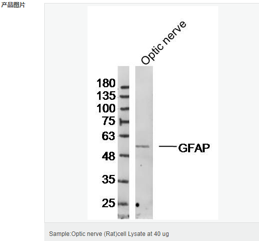 60612bd4aef4d.png image.png