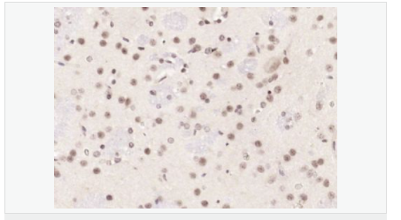 6065717fccb2d.png image.png