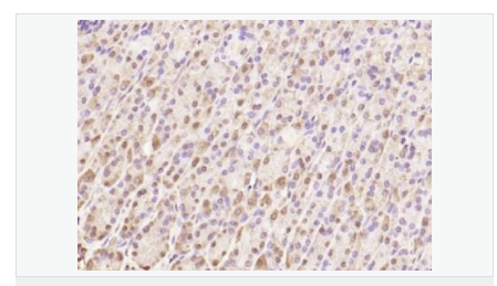 6076454b3330e.png image.png