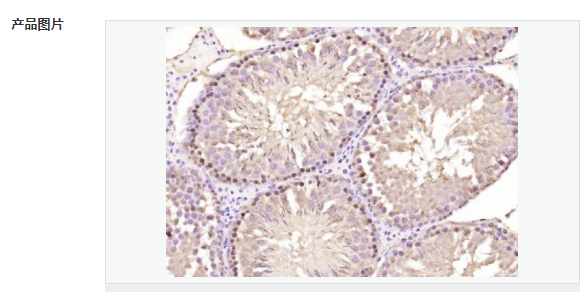 6078ed626c15a.png image.png